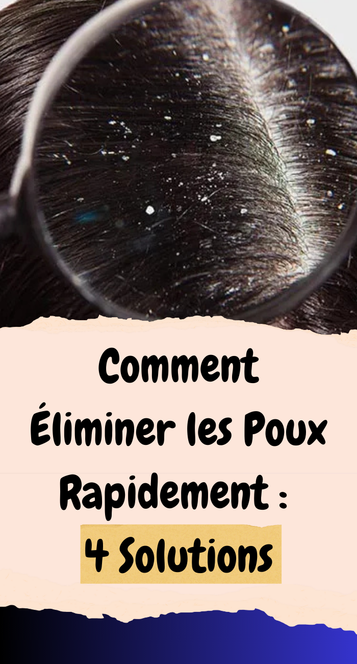 Comment Éliminer les Poux Rapidement