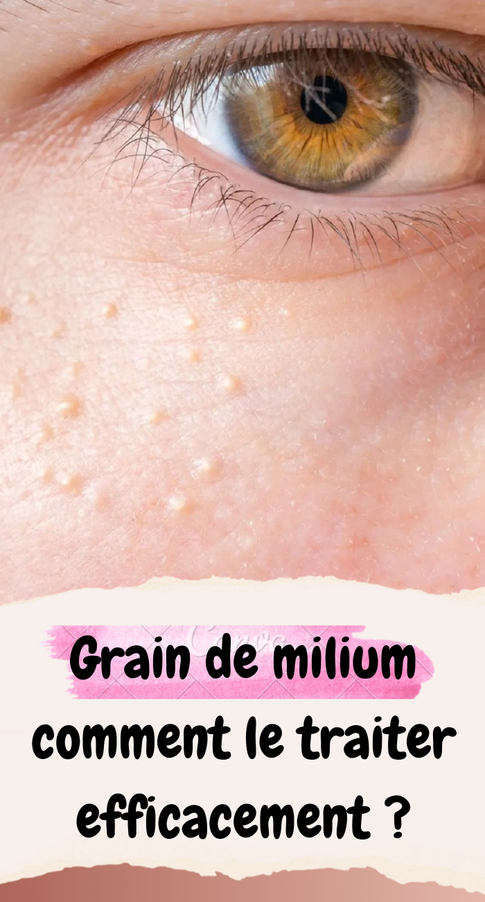 Grain de milium