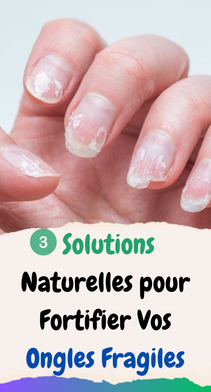 Vos ongles sont abîmés, mous, cassants, striés ou se dédoublent ?