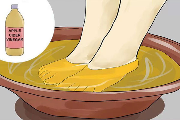 Trempez vos pieds dans le vinaigre